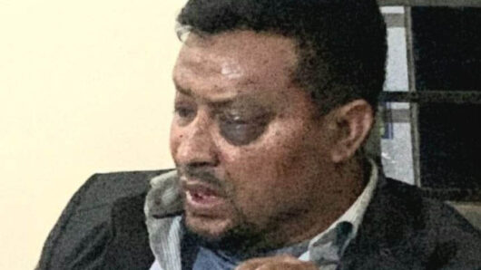 প্রচারণা শেষে ফেরার পথে দিরাইয়ে বিএনপি নেতা আজমল চৌধুরীর ওপর হা ম লা