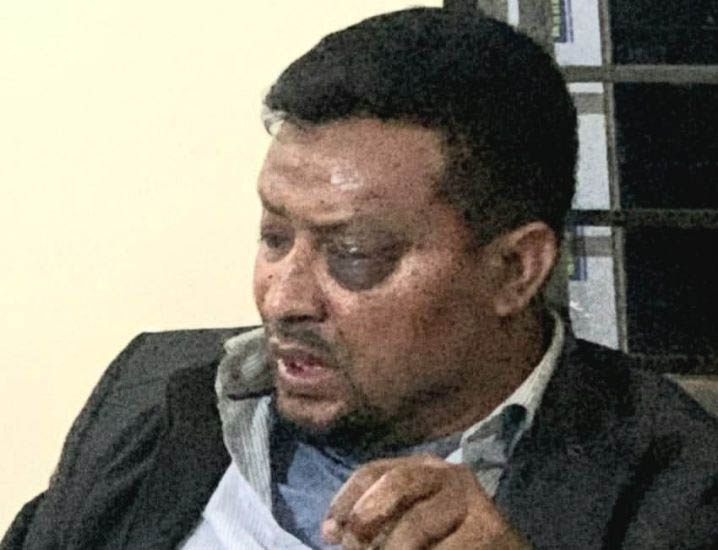 প্রচারণা শেষে ফেরার পথে দিরাইয়ে বিএনপি নেতা আজমল চৌধুরীর ওপর হা ম লা