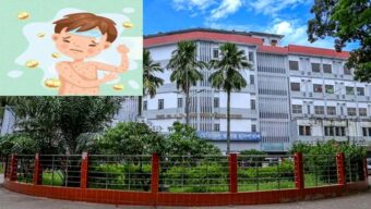 সিলেটে বাড়ছে হাম রোগী, ওসমানীতে প্রস্তুত নতুন শিশু ইউনিট